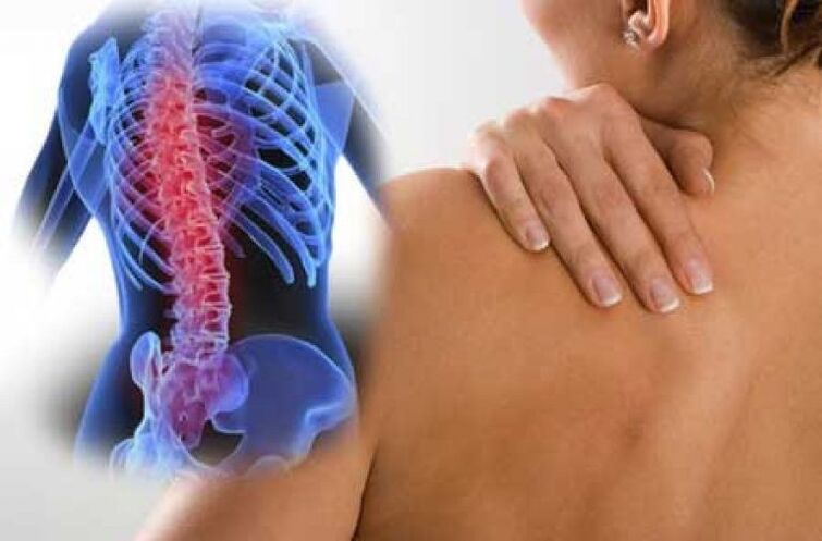 Coa osteocondrose, a dor pode irradiarse a partes distantes do corpo