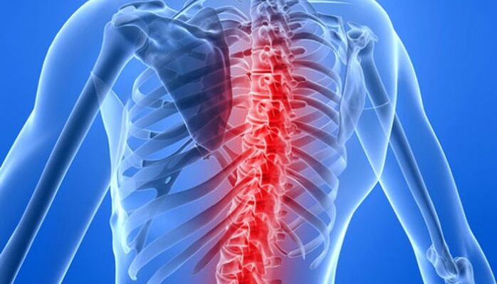 As patoloxías da columna vertebral son as causas máis comúns de dor nas costas na zona do omóplato