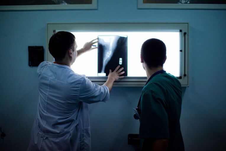 Diagnóstico da artrose en x -ray