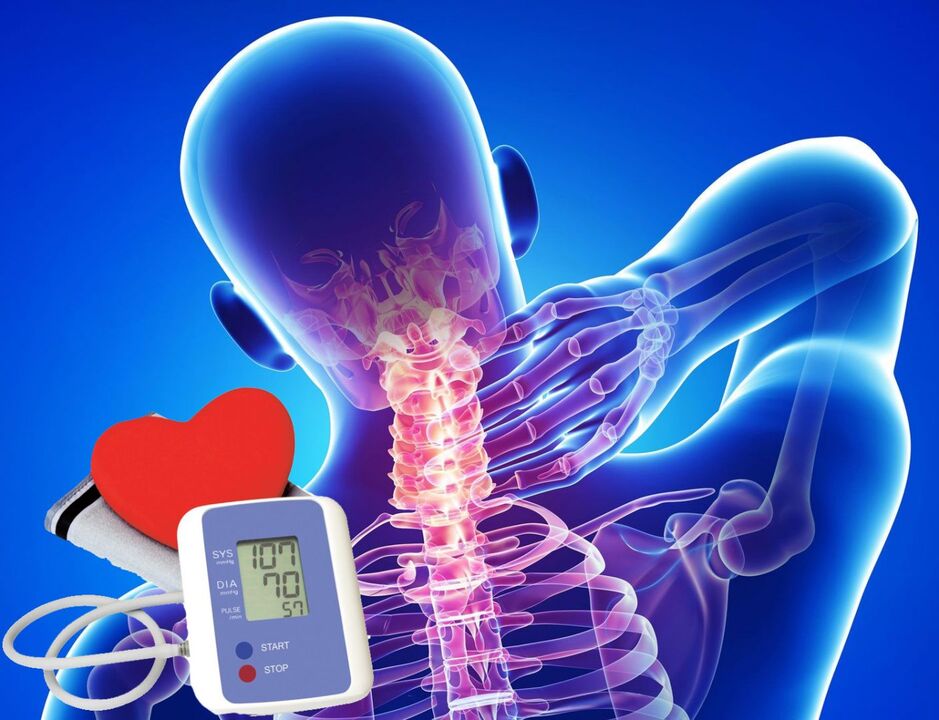 Saltos na presión arterial con osteocondrose cervical